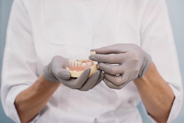 What To Do After Damaging A Dental Crown