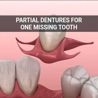 Visit our Partial Denture for One Missing Tooth page
