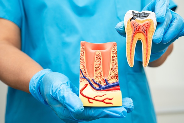 Possible Complications Of Root Canals And How To Avoid Them